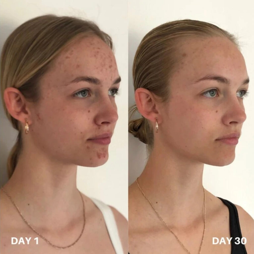CLINISOOTHE+ - Skin Purifier - Tonikum pro aknózní a citlivou pleť - Obrázek 2